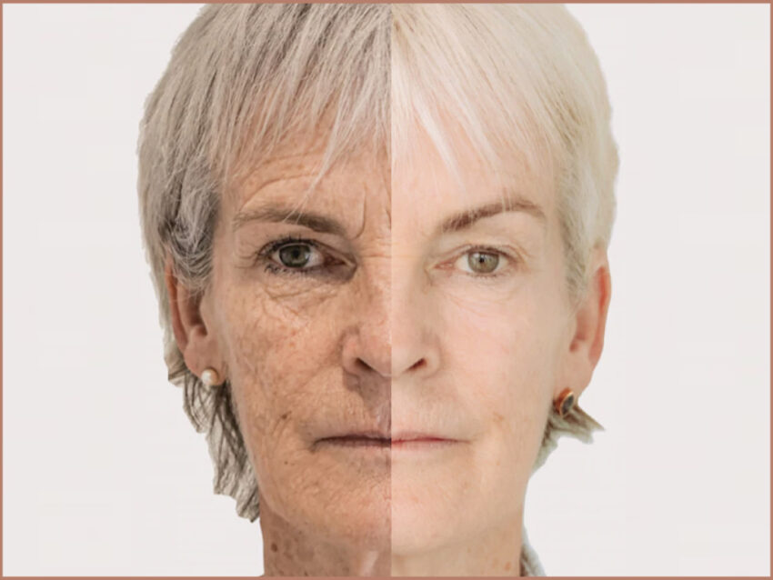Durham aesthetician reveals the non-surgical treatment behind Judy Murray’s transformation