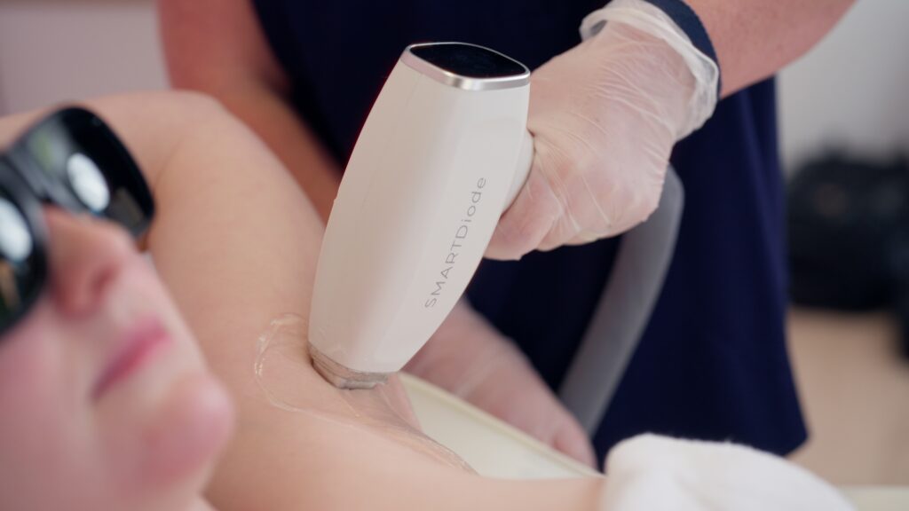 The new innovative laser hair removal technology that’s super fast and pain-free