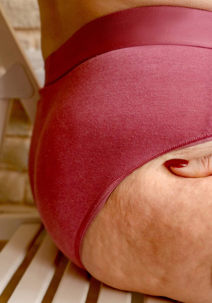 woman sat on chair showing cellulite