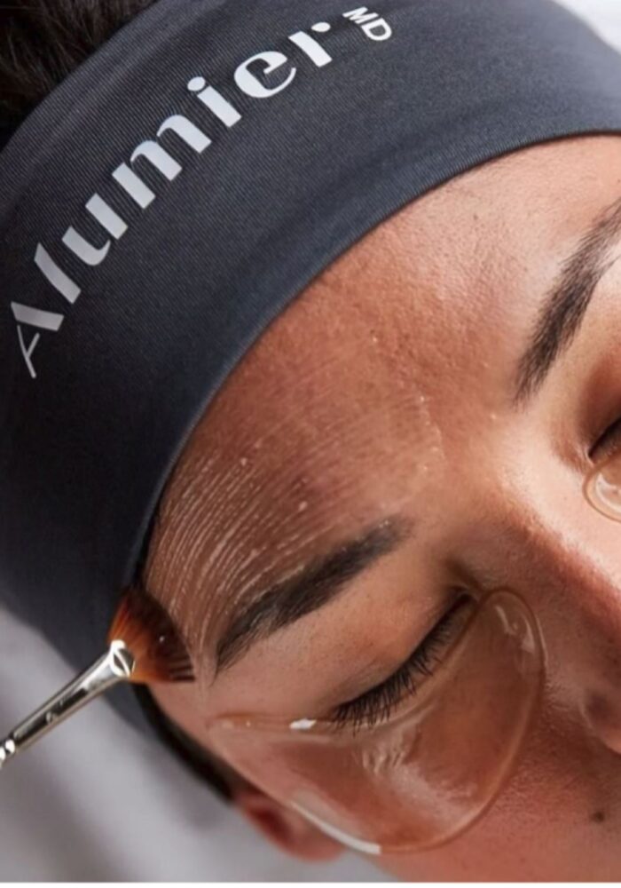 RT Aesthetics Skincare Peels Whickham