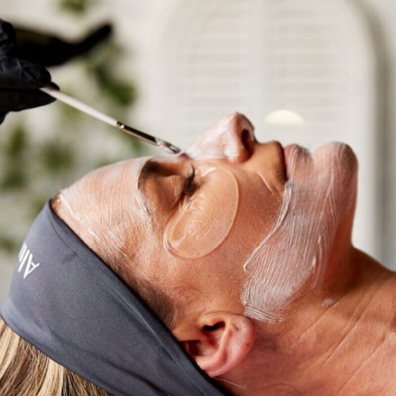RT Aesthetics Chemical Peel Facial – from £150.00
